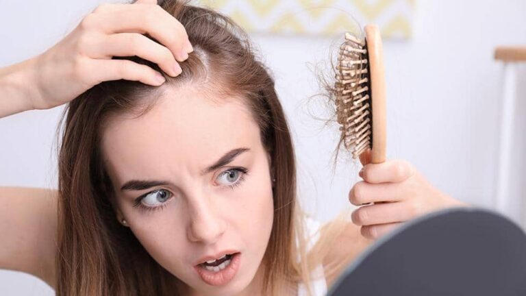 Nỗi lo rụng tóc ở phái đẹp
